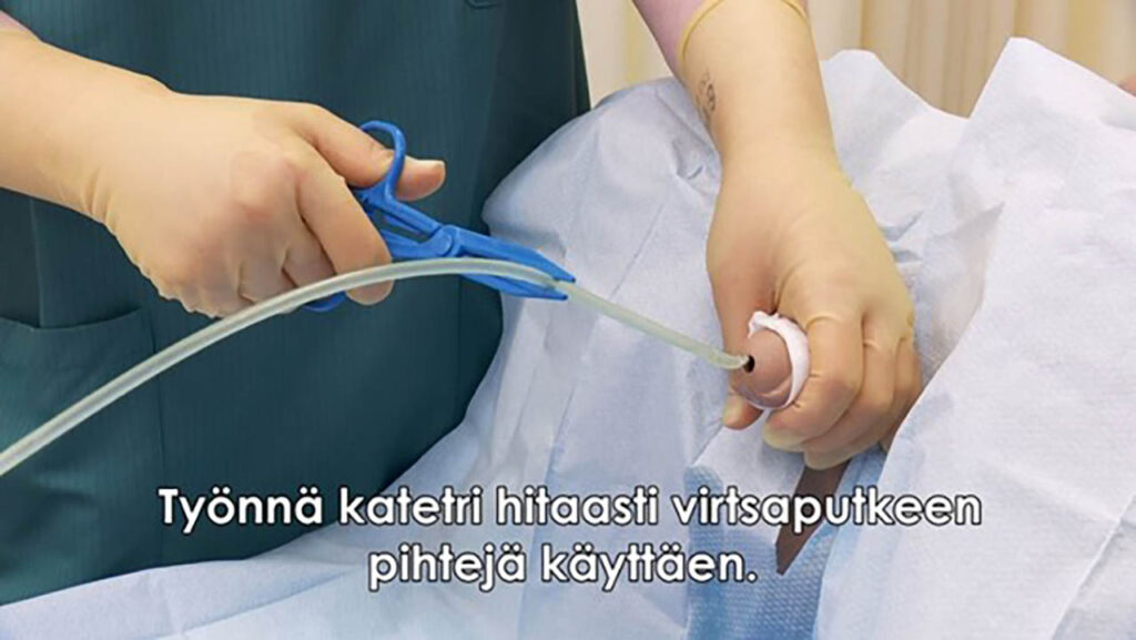 [Alt-teksti: Opetusnukelle tehtävä toimenpide. Hansikoidut kädet vievät steriiliä ohutta katetria virtsaputken suulle. Opetusnuken lantion alue ja alavatsa on peitelty steriileillä liinoilla.]