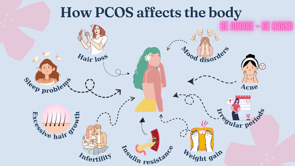 [Alt text: a picture with title how pcos affects the body, information includes mood disorders, irregular periods, insulin resistance and so forth.]