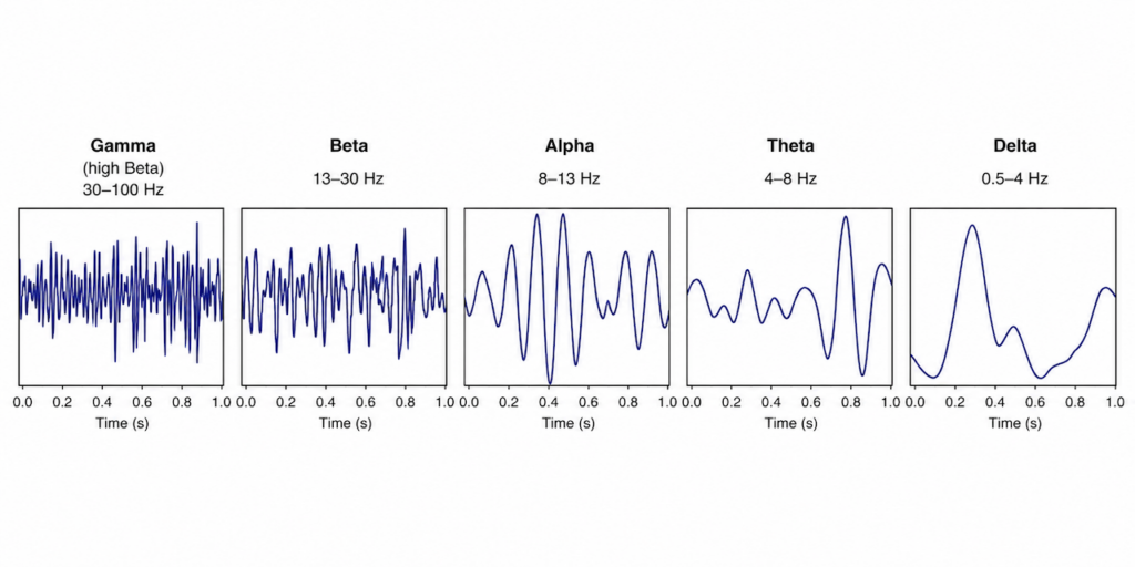 Yhdessä rivissä viisi ruutua, joissa jokaisessa on esitetty vaihteleva-amplituidinen signaali aika-akselilla. Ruudut on otsikoitu Gamma 30-100Hz, Beta 13-30Hz, Alpha 8-13Hz, Theta 4-8Hz ja Delta 0.5-4Hz vasemmalta oikealle.